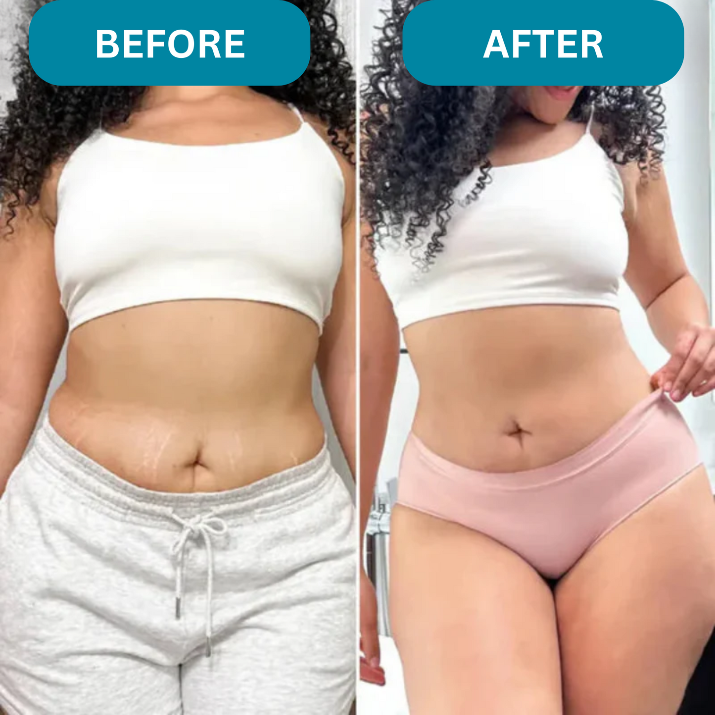 Silkiora™ Anti-Cellulite Massager